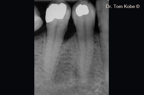 Fig. 10 Initial radiograph