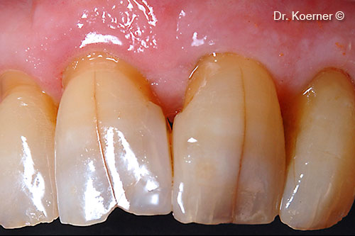 11. clinical situation 10 years post-op