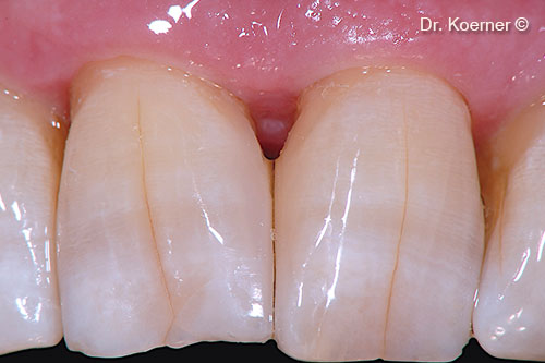 10. clinical situation 6 months post-op