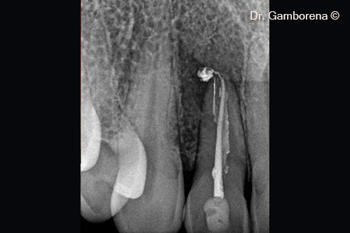 2. x-ray initial situation