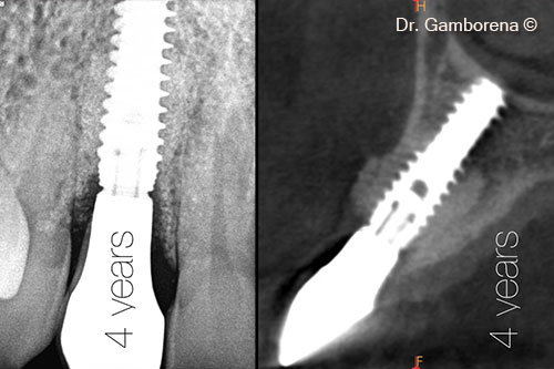 27. xrays 4 years