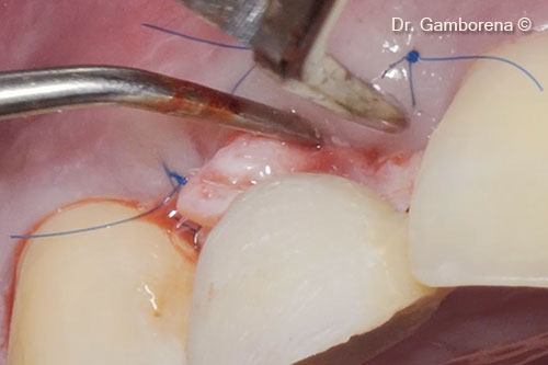 18. Circular tCTG