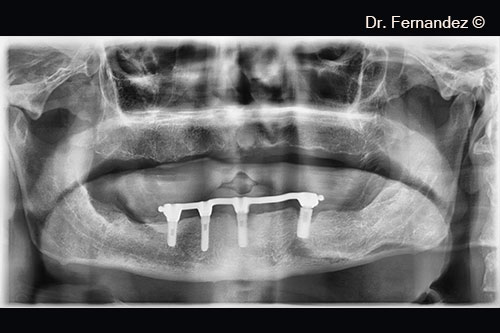 Initial radiological appearance.