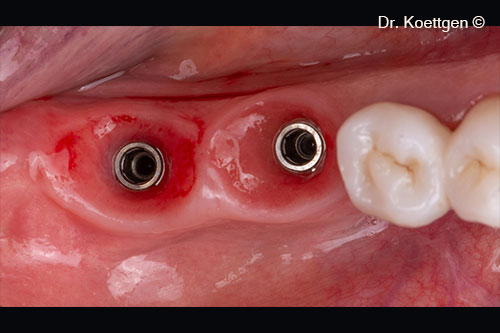 Occlusal view